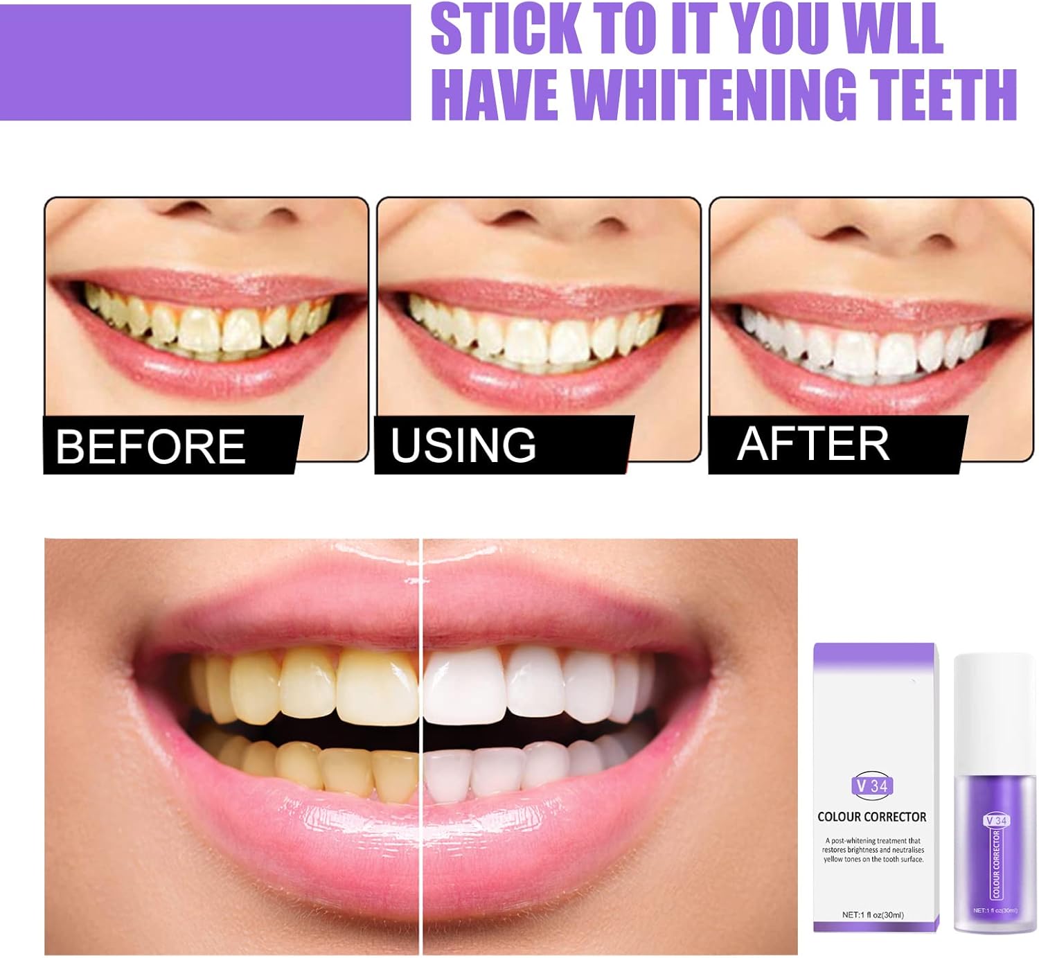 Hismile v34 Colour Corrector Serum Purple Teeth Whitening & Stain Removal