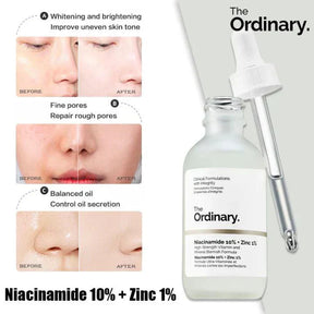 Original Niacinamide Sales 25% OFF🔥 Serum For All Skin, Import Product