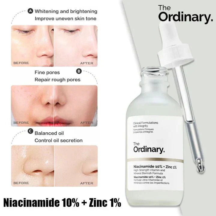 Original Niacinamide Sales 25% OFF🔥 Serum For All Skin, Import Product